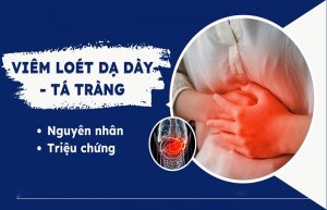 viêm loét dạ dày tá tràng