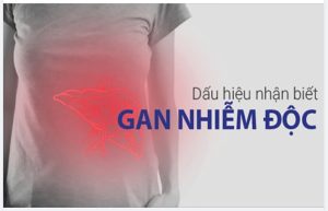 dấu hiệu trên mặt cảnh báo bệnh gan