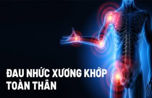 đau nhức xương khớp