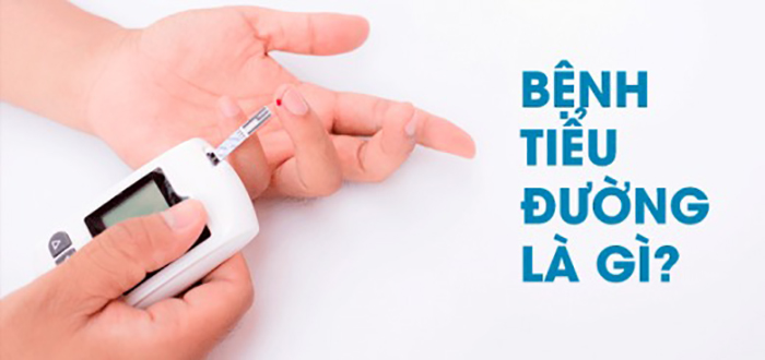 Bệnh tiểu đường là gì? Nguyên nhân và cách phòng tránh