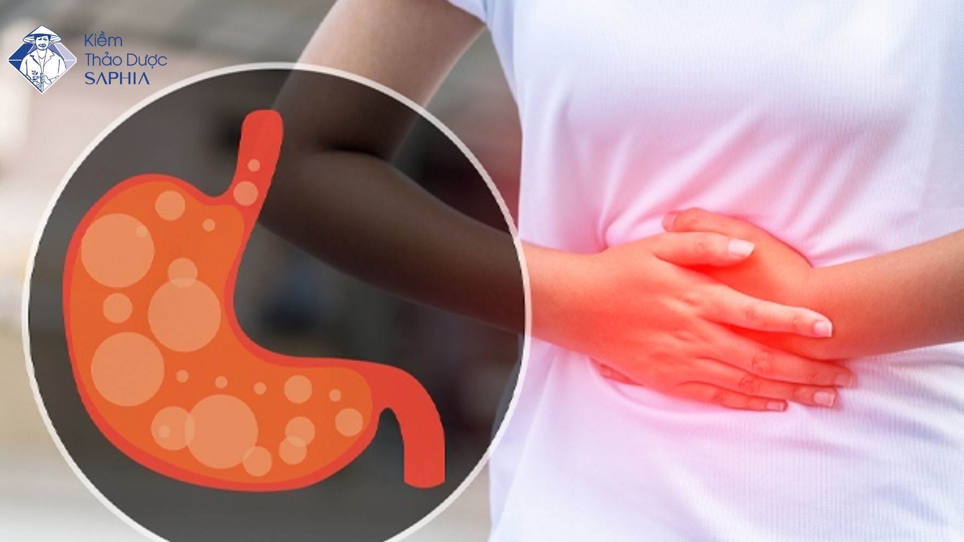 Dư axit dạ dày: Nguyên nhân, triệu chứng và cách cải thiện