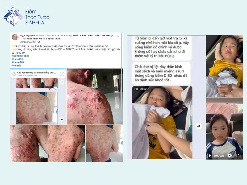 Hình ảnh thực tế của khách hàng sau khi đã sử dụng sản phẩm Kiềm thảo dược Saphia