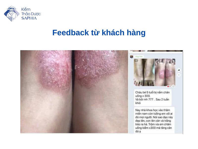 Sức khỏe khách hàng được cải thiện khi dùng Kiềm thảo dược Saphia