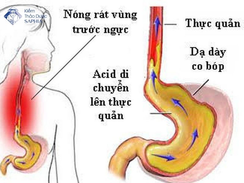 Trao Nguoc Da Day An Gi Tot 1