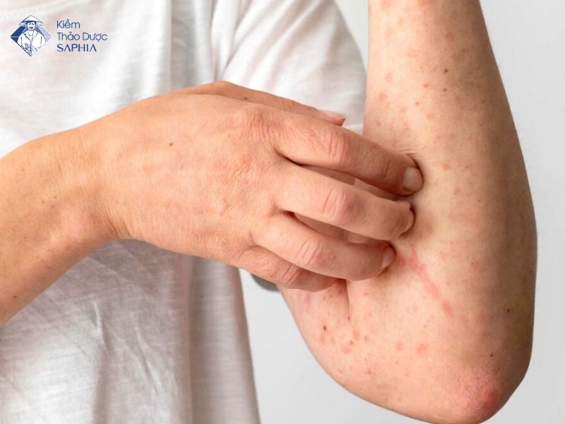 Cac Cach Thai Doc Gan 3