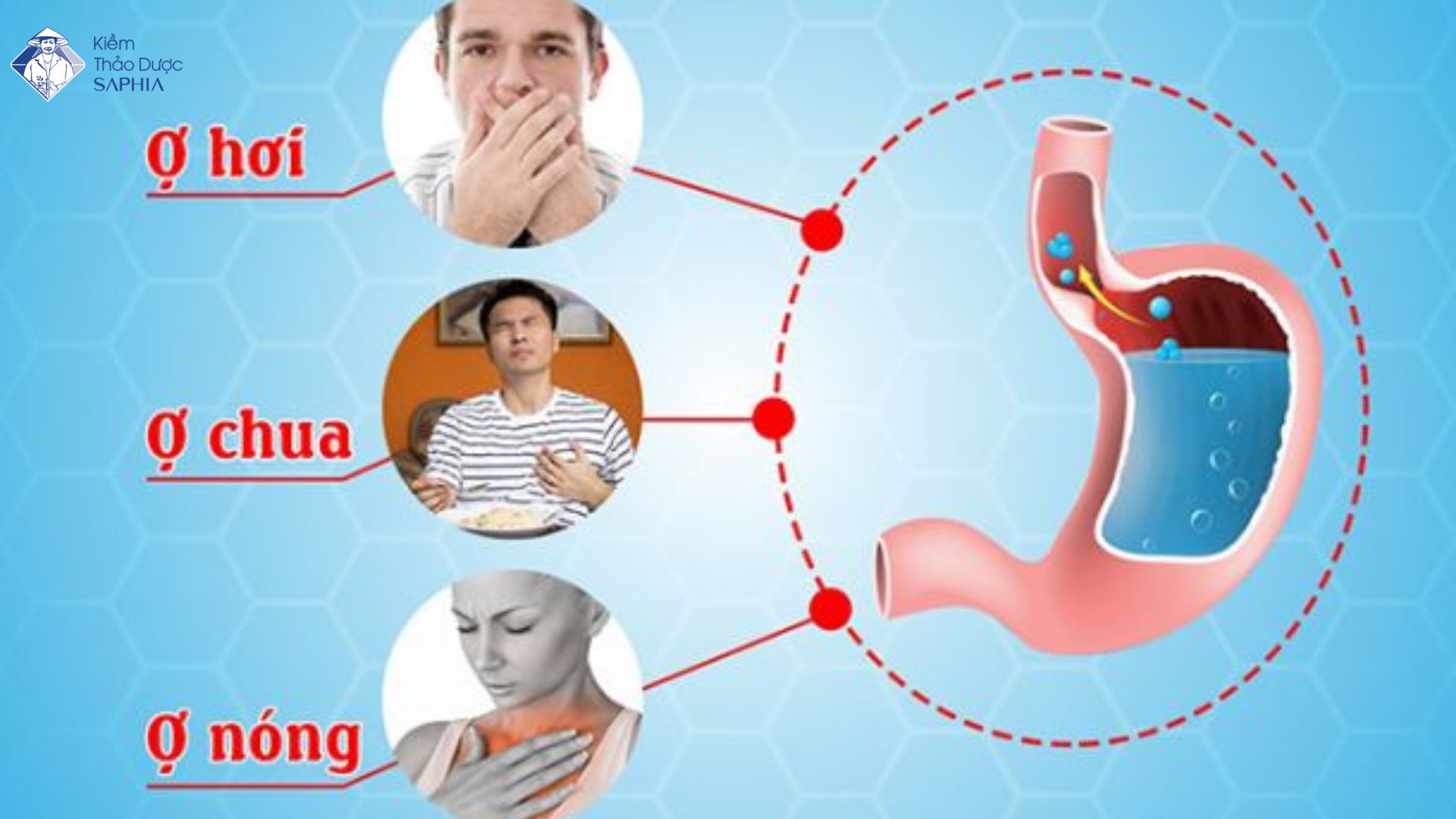 Bật mí cách trung hòa axit dạ dày hiệu quả