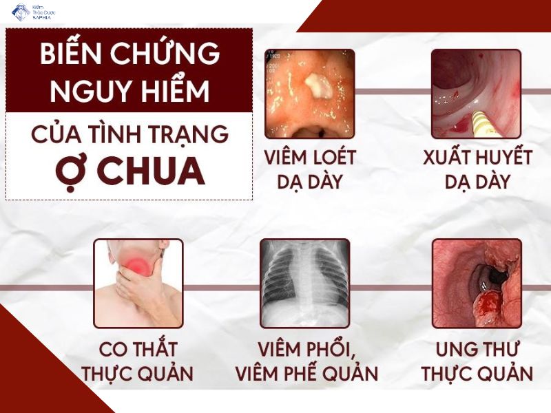 Cach Trung Hoa Axit Da Day 3