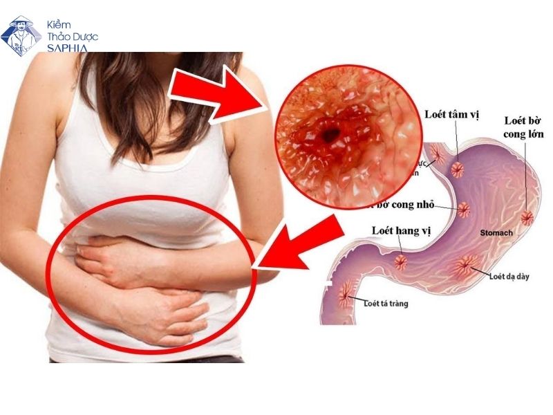 Che Do An Uong Cho Nguoi Dau Da Day 1