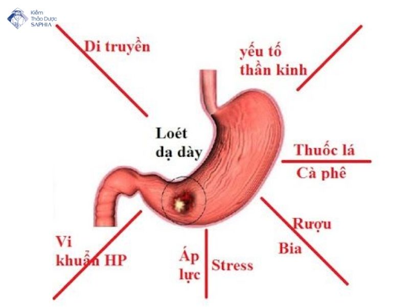 Che Do Dinh Duong Cho Nguoi Viem Loet Da Day 2