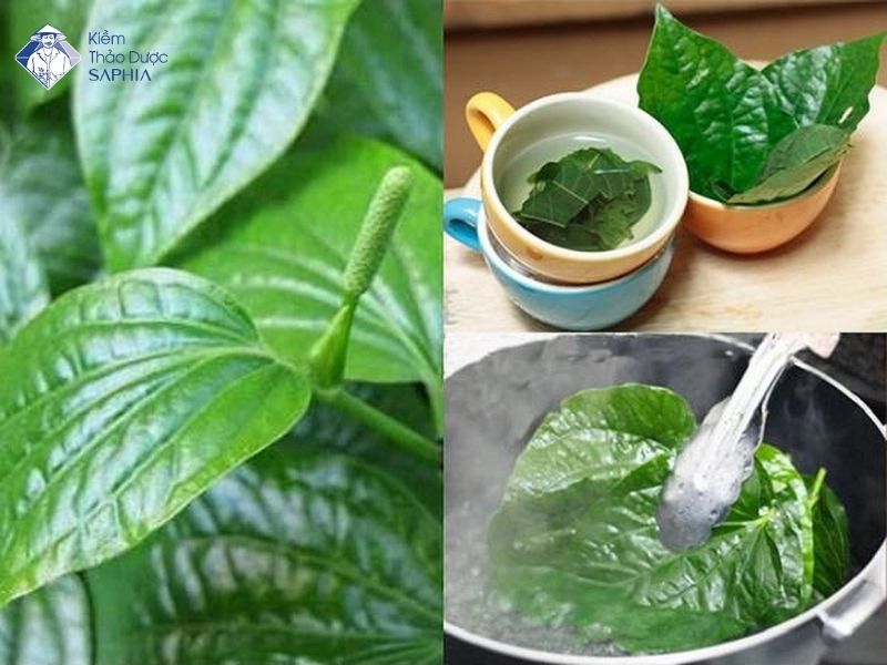 La Lot Co Tri Dau Xuong Khop Khong 3