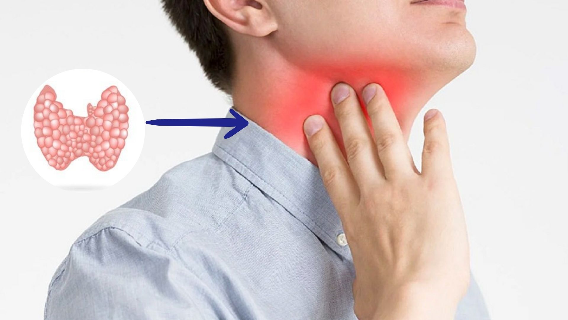 Uống gì tốt cho tuyến giáp và các lưu ý quan trọng cần biết