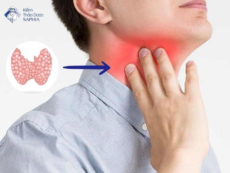 Uong Gi Tot Cho Tuyen Giap 1