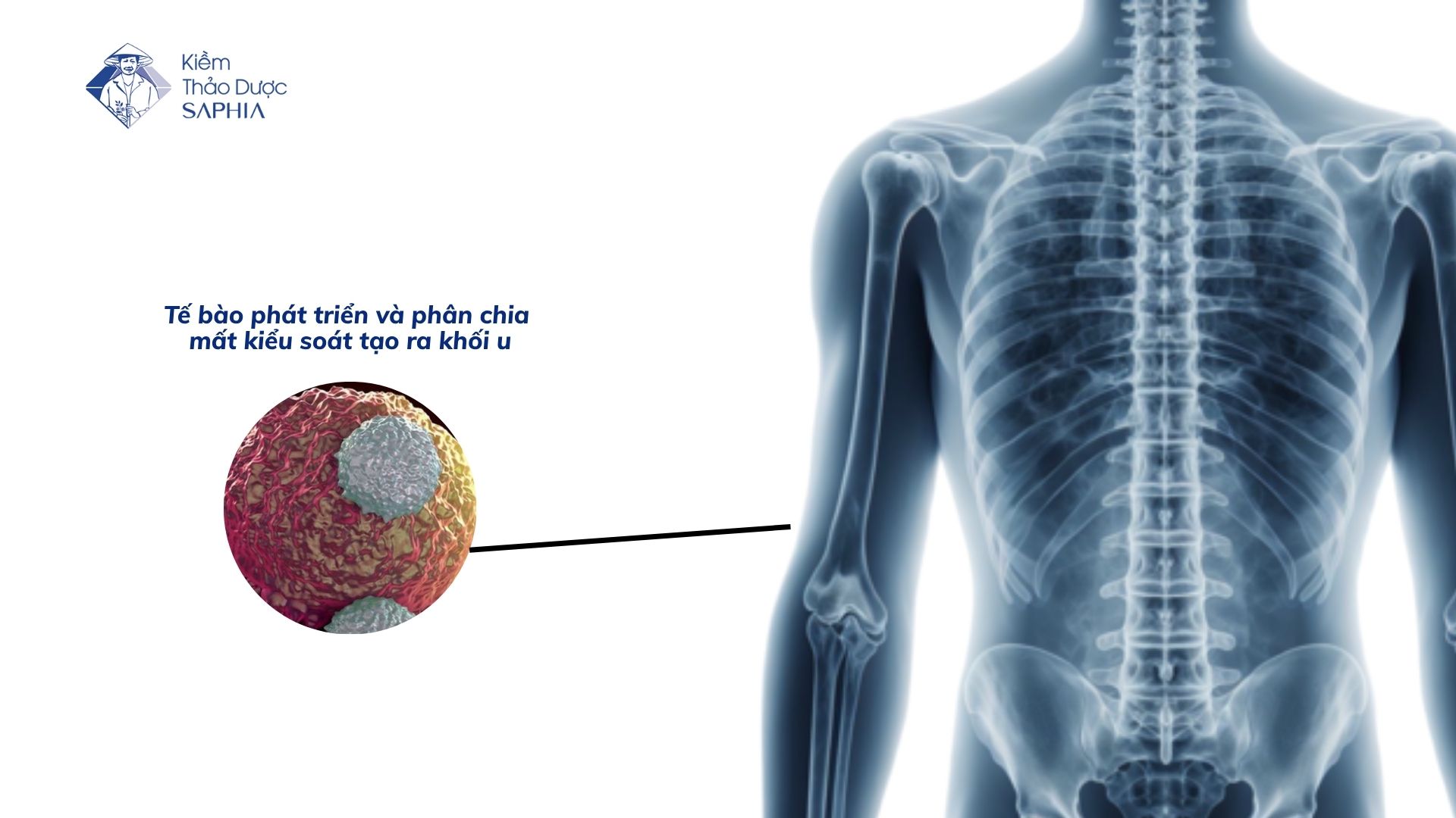 7 cách phòng tránh ung thư hiệu quả bạn không nên bỏ lỡ