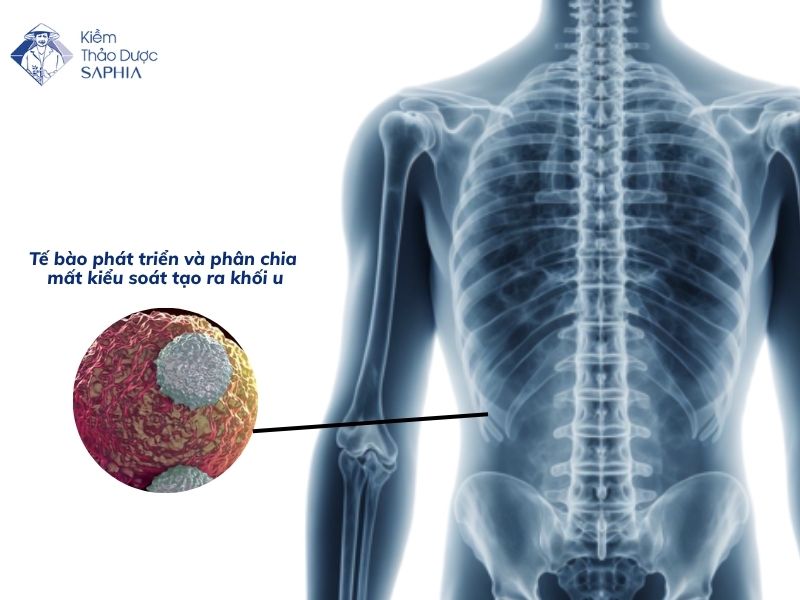 Cach Phong Tranh Ung Thu 1