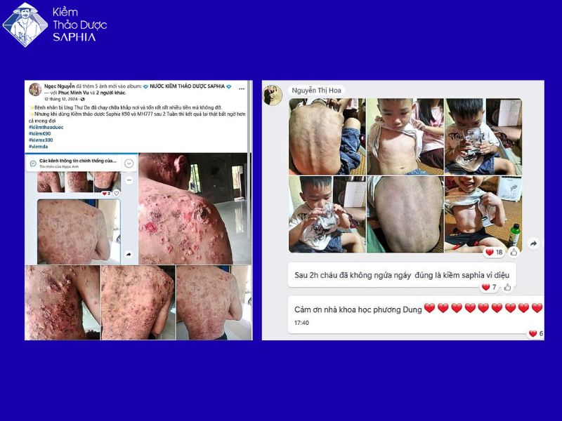 Nuoc Kiem Khang Khuan 4