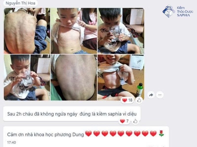 Nuoc Kiem Rua Vet Thuong 5