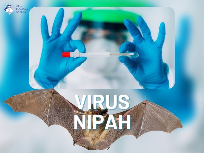 Virus Nipah 1